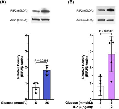 Interleukin-1 receptor-dependent and -independent caspase-1 activity in retinal cells mediated by receptor interacting protein 2